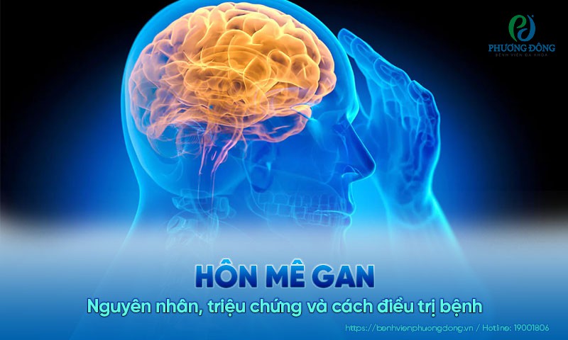 Hôn mê gan: Nguyên nhân, triệu chứng và cách điều trị bệnh