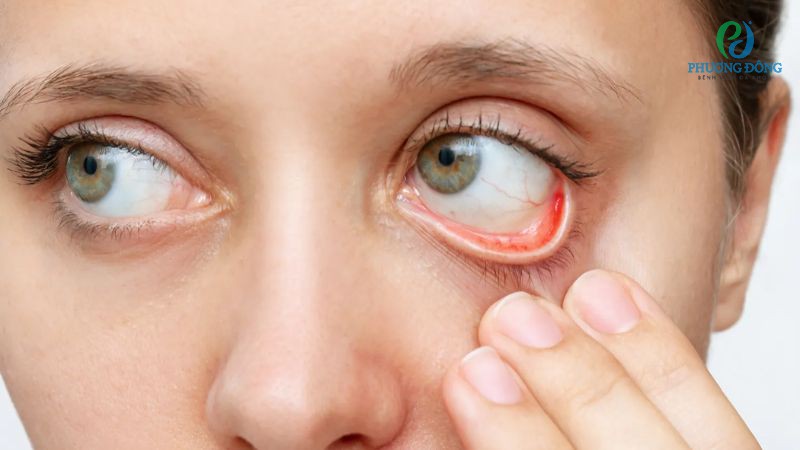 Kết mạc có chức năng bảo vệ mắt, ngăn chặn sự xâm nhập của các tác nhân gây hại