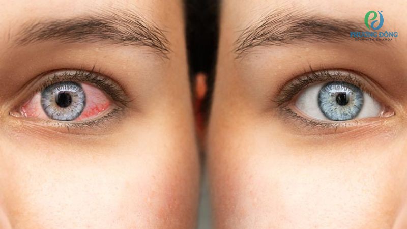 Kết mạc sở hữu hai đặc điểm sinh lý chính là tái tạo nhanh và miễn dịch tốt