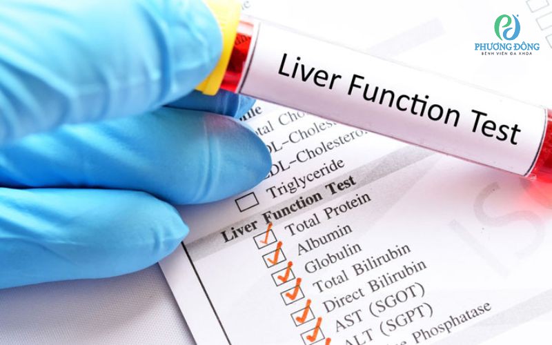 Kiểm tra chức năng gan là gì? Khi nào cần thực hiện?
