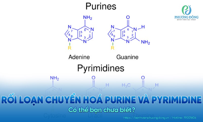 Rối loạn chuyển hoá Purine và Pyrimidine là gì? Có thể bạn chưa biết?