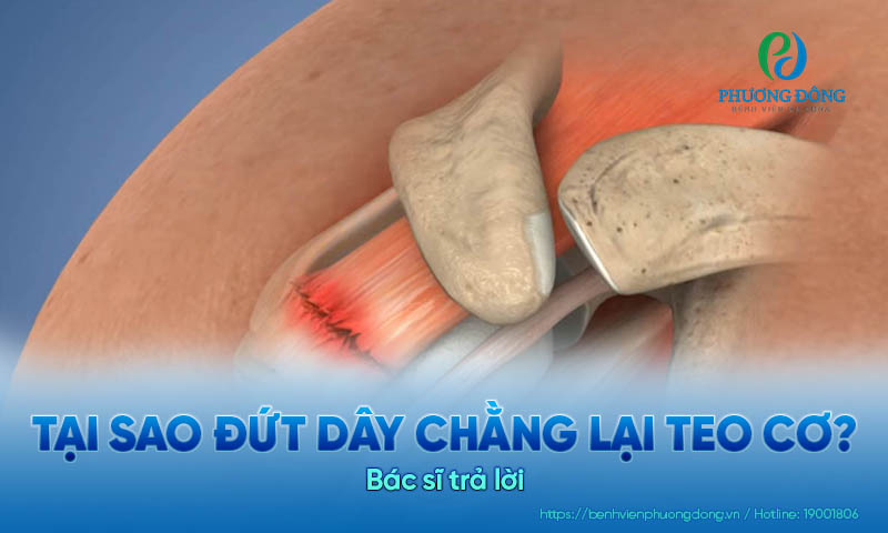Bác sĩ trả lời: Tại sao đứt dây chằng lại teo cơ?
