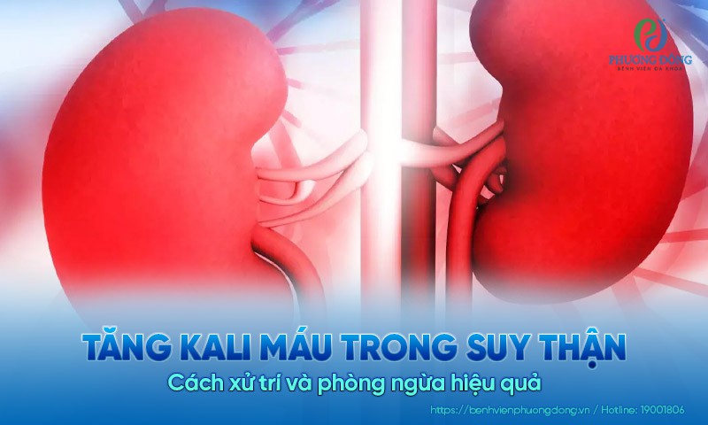 Tăng kali máu trong suy thận: Cách xử trí và phòng ngừa hiệu quả