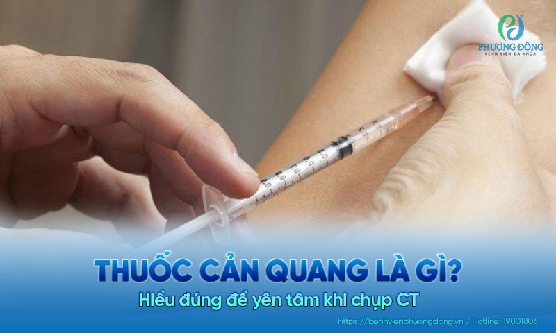 Thuốc cản quang là gì trong chẩn đoán hình ảnh: Hiểu đúng để yên tâm khi chụp CT