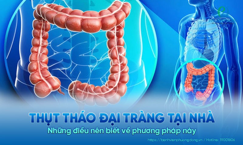 Tìm hiểu về phương pháp thụt tháo đại tràng tại nhà