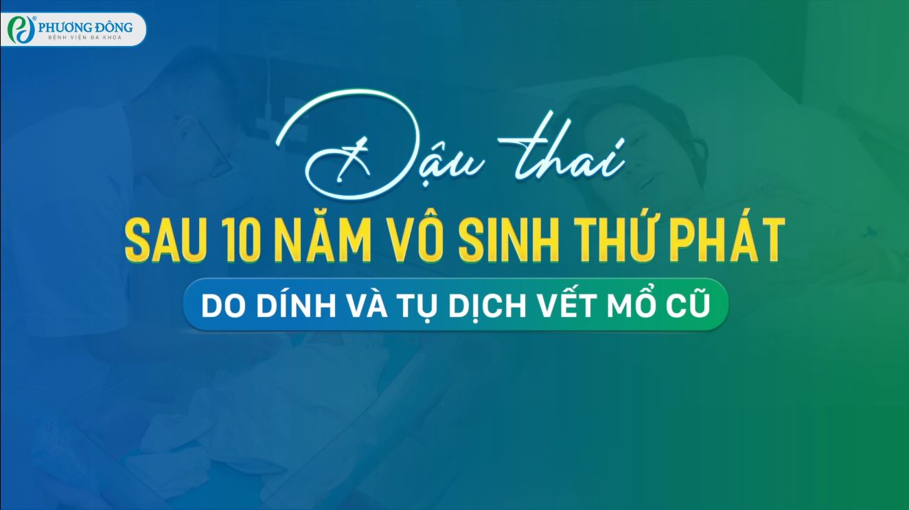 Đậu thai sau 10 năm vô sinh thứ phát do dính và tụ dịch vết mổ cũ