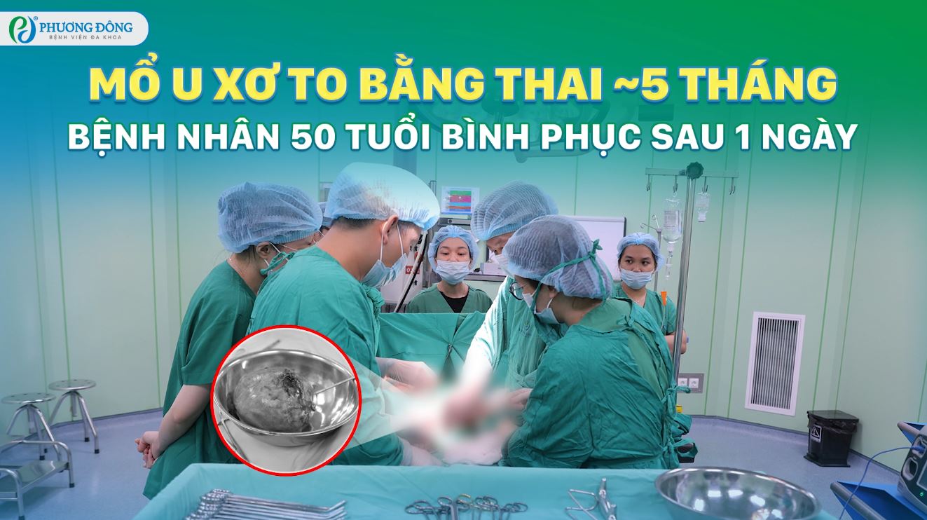 Mổ u xơ to bằng thai ~5 tháng, bệnh nhận 50 tuổi bình phục sau 1 ngày
