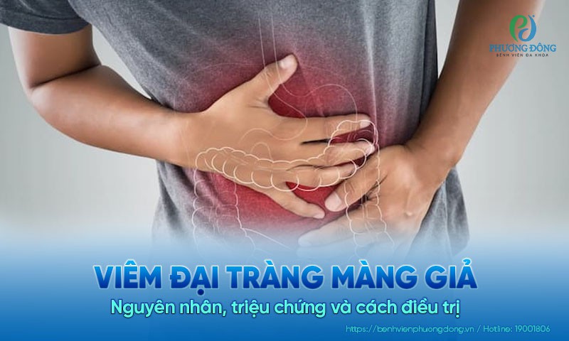 Viêm đại tràng màng giả: Nguyên nhân, triệu chứng và cách điều trị