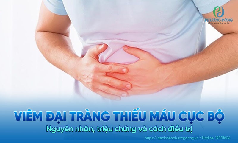 Viêm đại tràng thiếu máu cục bộ: Nguyên nhân, triệu chứng và cách điều trị