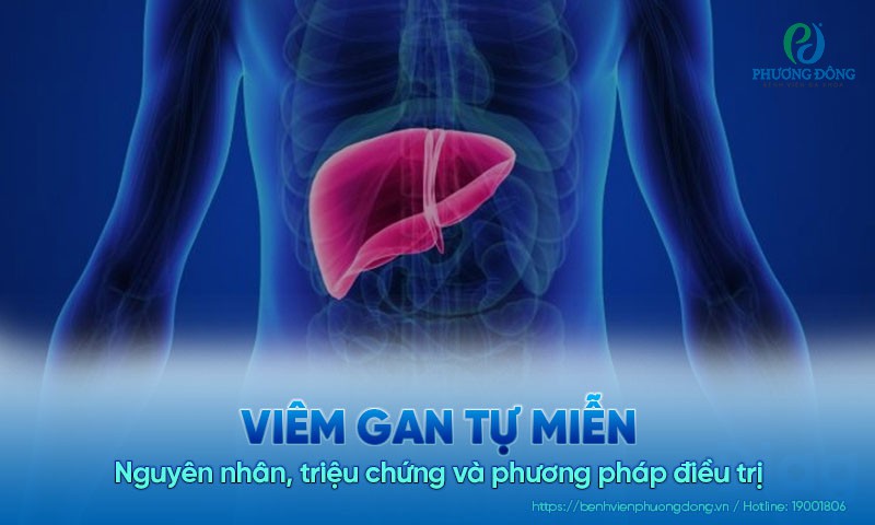 Viêm gan tự miễn: Nguyên nhân, triệu chứng và phương pháp điều trị