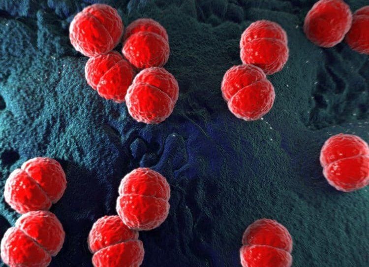 Nguy cơ tử vong trong 24 giờ từ dầu hiệu sốt do viêm màng não mô cầu