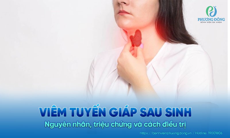 Viêm tuyến giáp sau sinh: Nguyên nhân, triệu chứng và cách điều trị