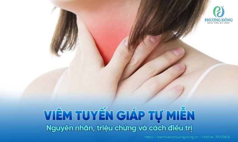 Viêm tuyến giáp tự miễn: Nguyên nhân, triệu chứng và cách điều trị