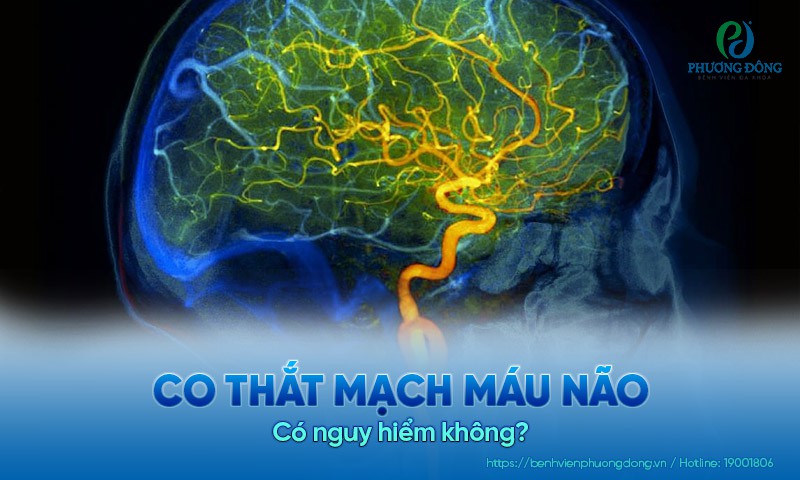 Co thắt mạch máu não có nguy hiểm không?