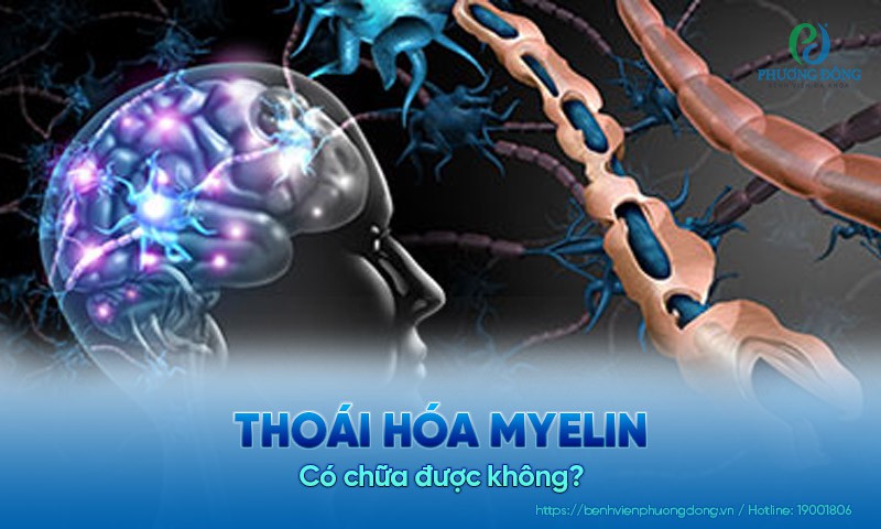 Thoái hóa myelin có chữa được không?