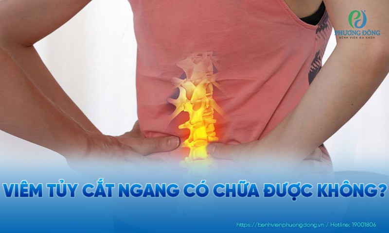 Viêm tủy cắt ngang có chữa được không?