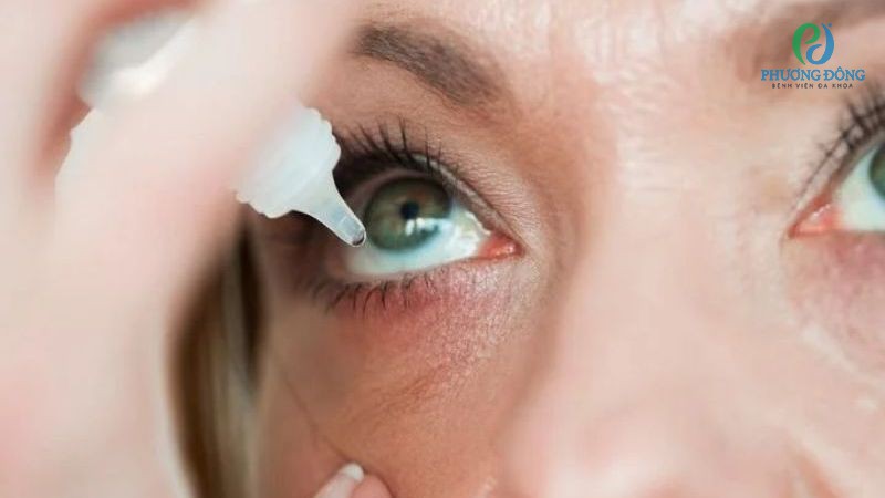 Giải đáp Nhãn khoa: Đau mắt hàn phải làm gì?