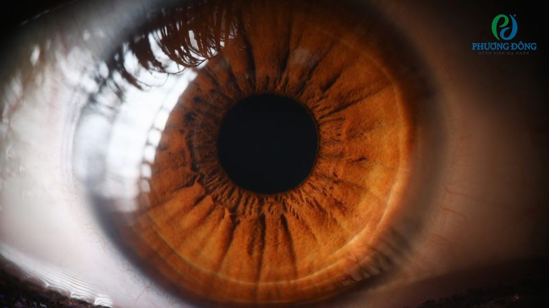 Giải đáp cùng bác sĩ: Thoái hóa võng mạc có nguy hiểm không?