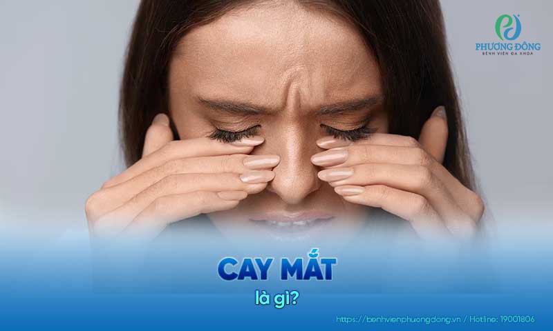 Cay mắt: Nguyên nhân, hướng điều trị và phòng ngừa