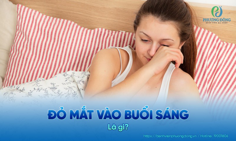 Đỏ mắt vào buổi sáng: Nguyên nhân và cách xử trí an toàn
