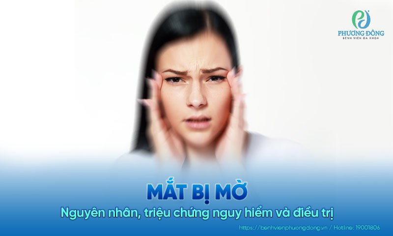Mắt bị mờ: Nguyên nhân, triệu chứng nguy hiểm và điều trị