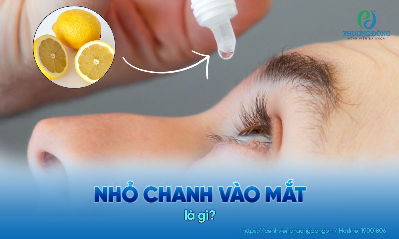 Nhỏ chanh vào mắt: Nguy cơ bỏng giác mạc và giảm thị lực