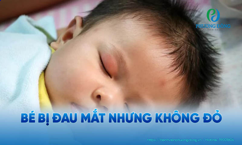 Có rất nhiều lý do khiến bé bị đau mắt