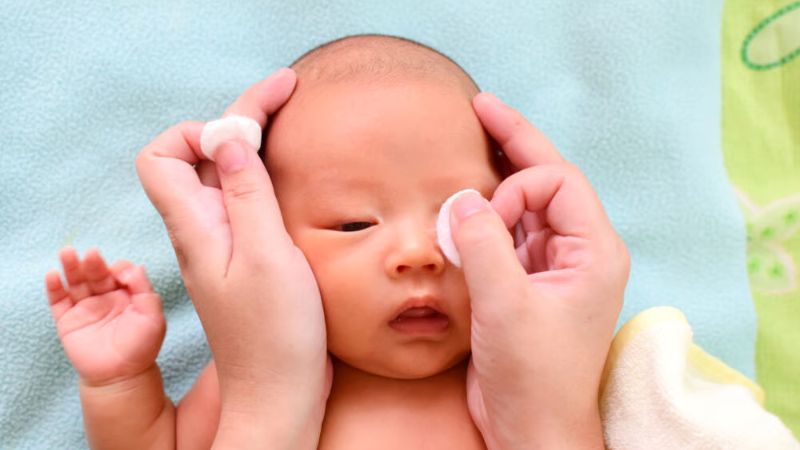 Cha mẹ hãy chú ý vệ sinh mắt cho bé 2 -3 lần/ ngày