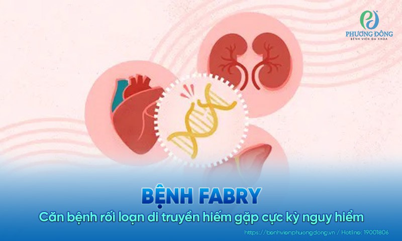 Bệnh Fabry: Căn bệnh rối loạn di truyền hiếm gặp cực kỳ nguy hiểm