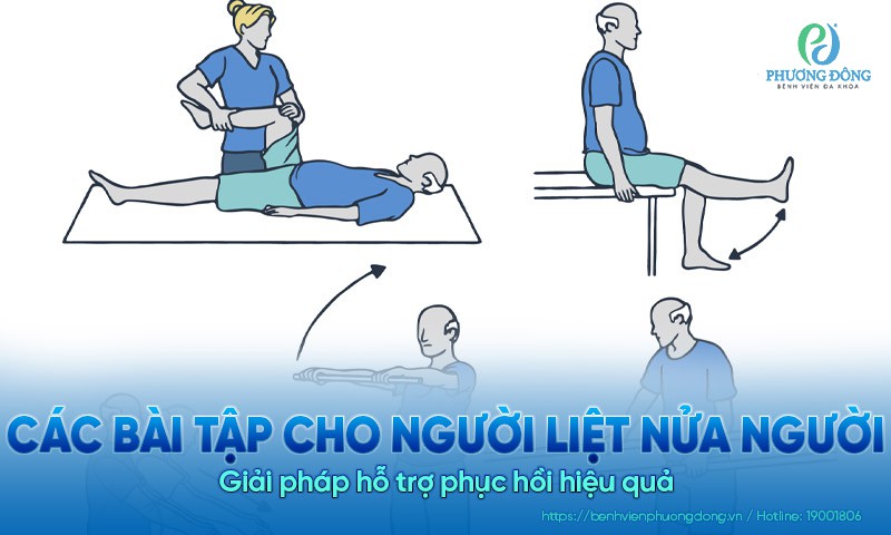 Các bài tập cho người liệt nửa người: Giải pháp hỗ trợ phục hồi hiệu quả