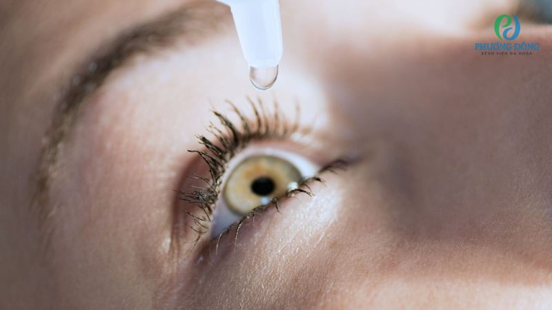 Dùng nước mắt nhân tạo đều đặn là cách hết mỏi mắt