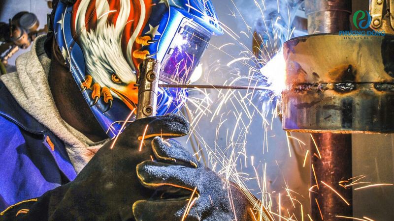 Biện pháp phòng ngừa đau mắt hàn xảy ra ở thợ hàn xì