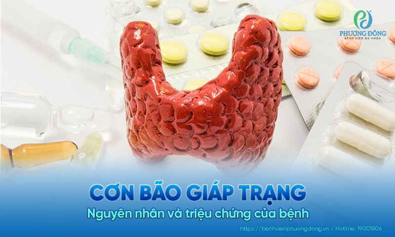 Cơn bão giáp trạng là gì? Nguyên nhân và triệu chứng của bệnh