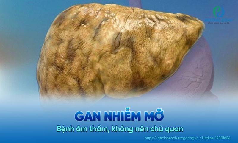 Gan nhiễm mỡ - Bệnh âm thầm, không nên chủ quan