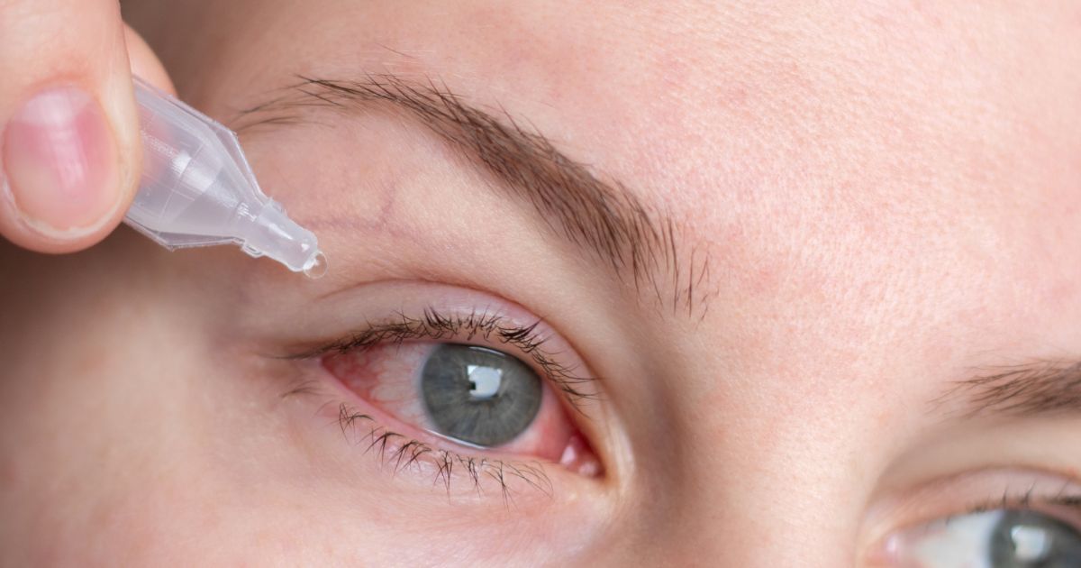 Nếu không điều trị kịp thời, bệnh có thể biến chứng thành viêm kết mạc