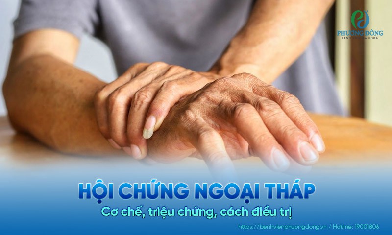 Hội chứng ngoại tháp: Cơ chế, triệu chứng, cách điều trị