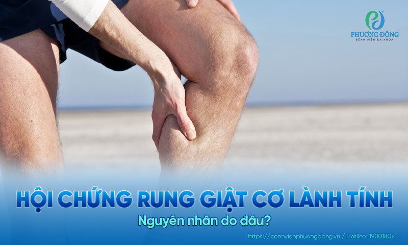 Hội chứng rung giật cơ lành tính: Nguyên nhân do đâu? 