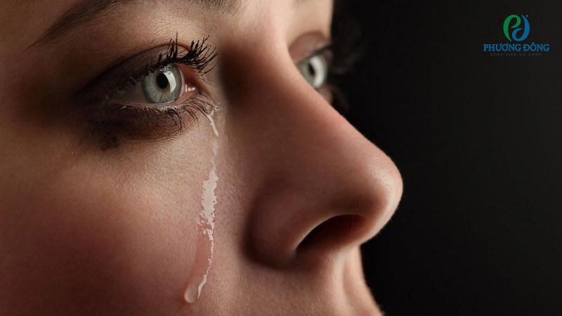 Bác sĩ Nhãn khoa giải đáp: Làm thế nào để khóc không bị sưng mắt?