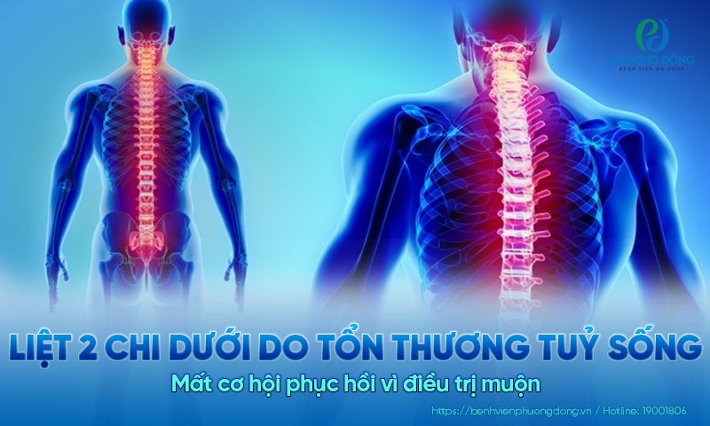 Liệt 2 chi dưới do tổn thương tuỷ sống: Mất cơ hội phục hồi vì điều trị muộn