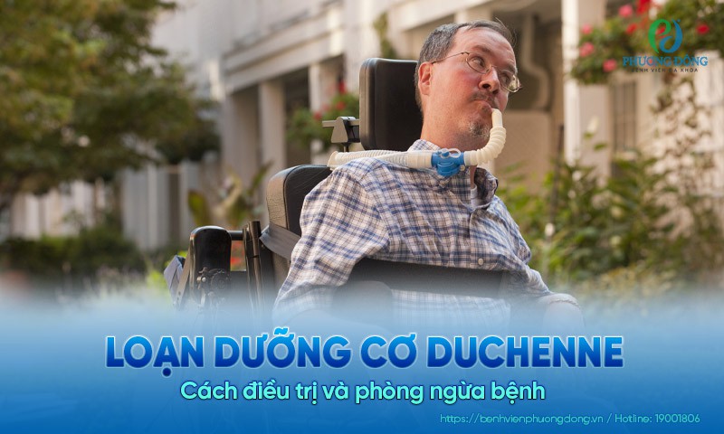Loạn dưỡng cơ Duchenne: Cách điều trị và phòng ngừa bệnh
