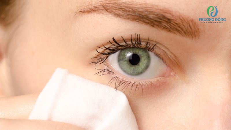 Phương pháp điều trị tròng trắng mắt nhiều mạch máu đỏ