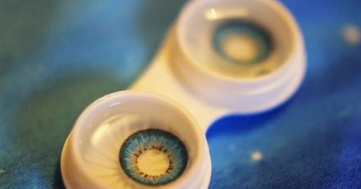 Dùng kính áp tròng không vệ sinh có thể khiến người bệnh có ghèn ở mắt