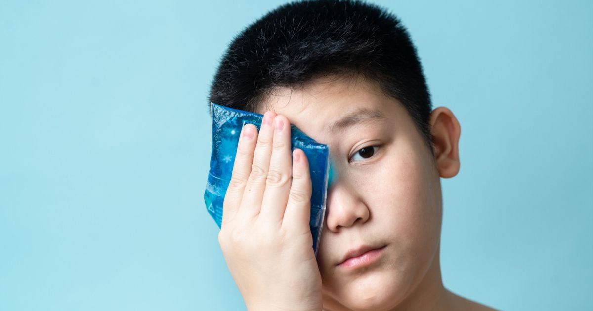 Bạn có thể chườm lạnh để hỗ trợ giảm sưng và đổ ghèn mắt