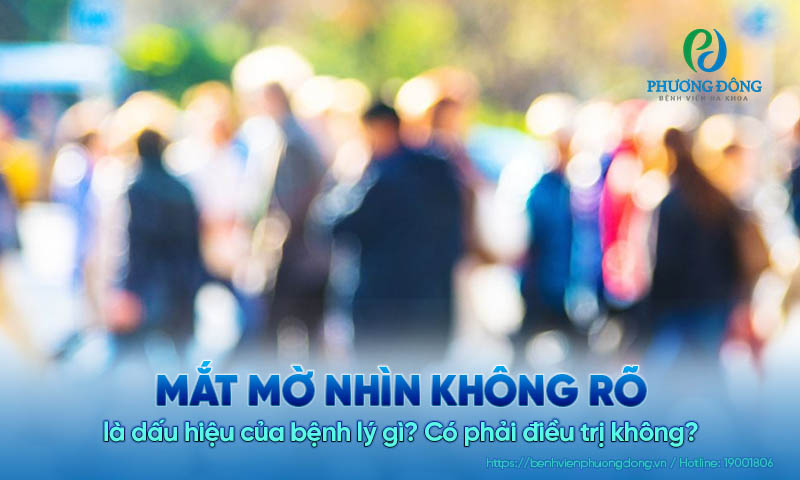 Mắt mờ nhìn không rõ là dấu hiệu của bệnh lý gì? Có phải điều trị không?