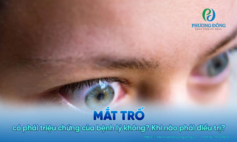 Mắt trố có phải triệu chứng của bệnh lý không? Khi nào phải điều trị?