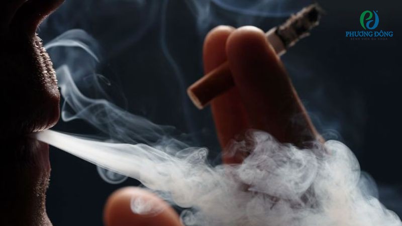 Nhóm yếu tố làm tăng nguy cơ mắt mất dần thị lực