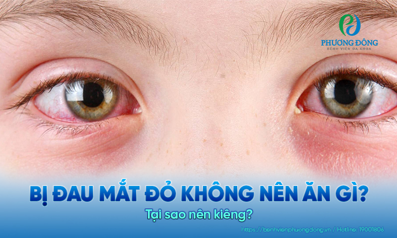 Bị đau mắt đỏ không nên ăn gì? Tại sao nên kiêng?
