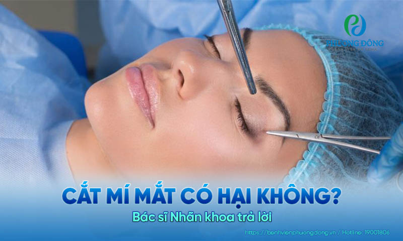 Bác sĩ Nhãn khoa trả lời: Cắt mí mắt có hại không?