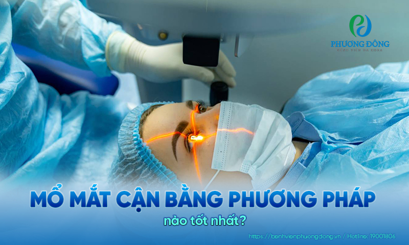 Mổ mắt cận bằng phương pháp nào tốt nhất?