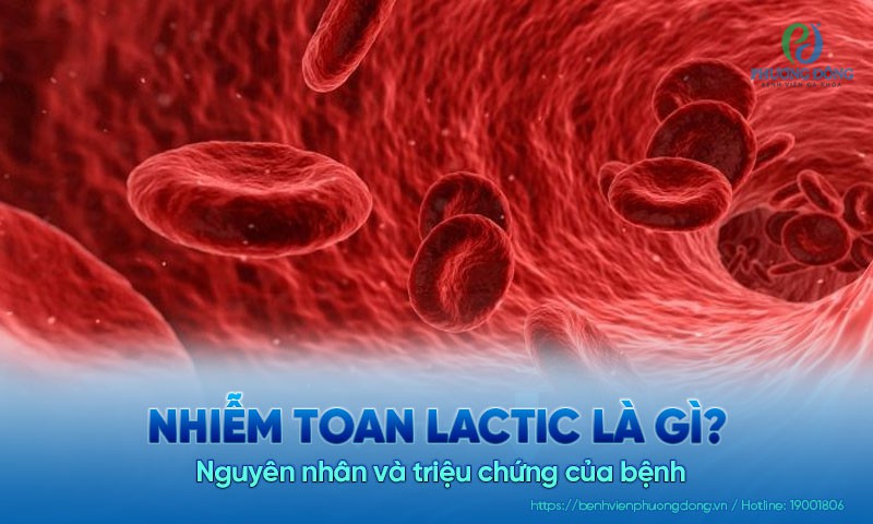 Nhiễm toan lactic là gì? Nguyên nhân và triệu chứng của bệnh